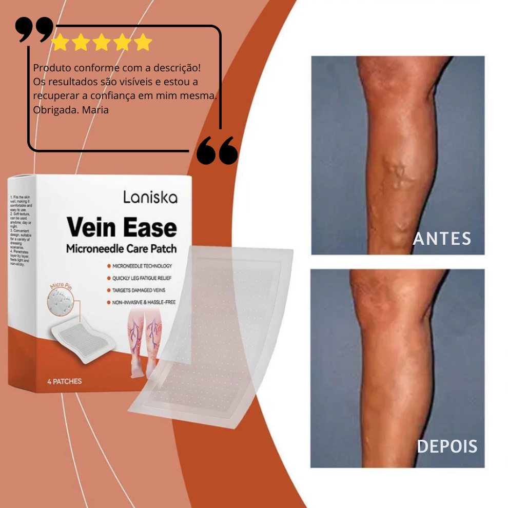 Microneedle Patch para varizes